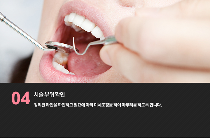 시술 부위 확인
정리된 라인을 확인하고 필요에 따라 미세조정을 하여 마무리를 하도록 합니다.