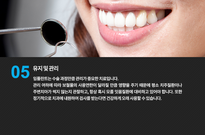 유지 및 관리
임플란트는 수술 과정만큼 관리가 중요한 치료입니다.
관리 여하에 따라 보철물의 사용연한이 달라질 만큼 영향을 주기 때문에 평소 치주질환이나 주변치아가 썩지 않는지 관찰하고, 항상 혹시 모를 잇몸질환에 대비하고 있어야 합니다. 또한 정기적으로 치과에 내원하여 검사를 받는다면 건강하게 오래 사용할 수 있습니다.